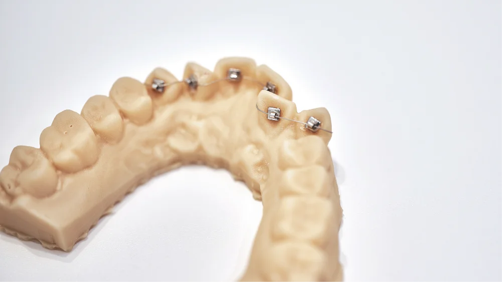 歯列矯正システムイメージ